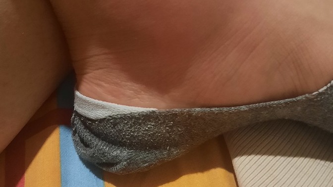 Ayak bileğim şiş ve çok kaşınıyor, neden olabilir?