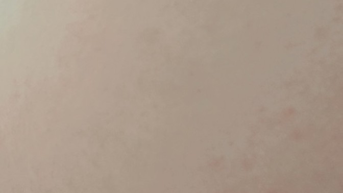 Bu kıl dönmesi mi acaba 😢?