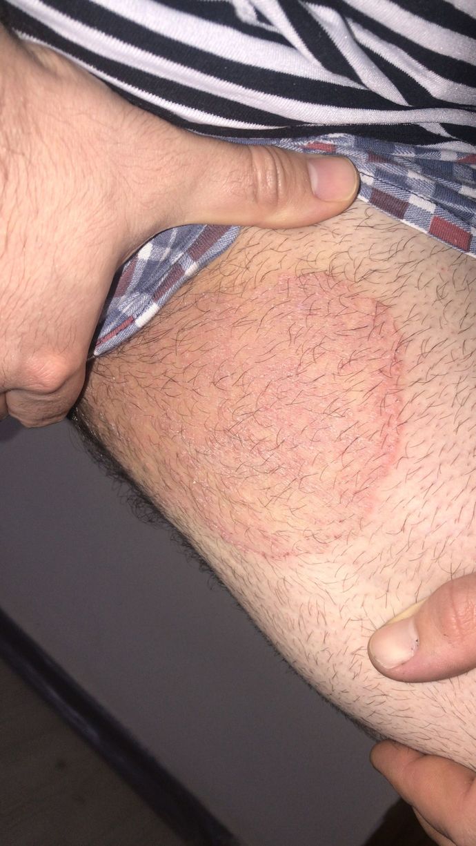 Aranızda cildiye bakan doktor var mı?