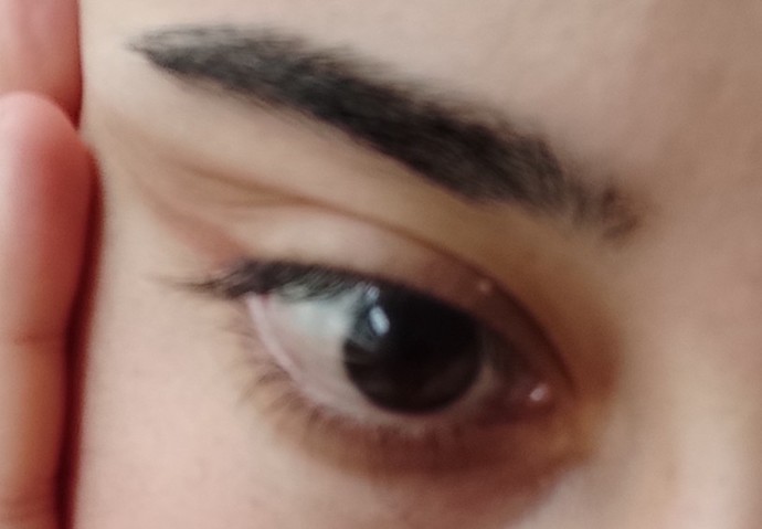 Gözümün beyaz kısmı neden lekeli duruyor sarı gibi anlamadım, bu nedir 🙄?