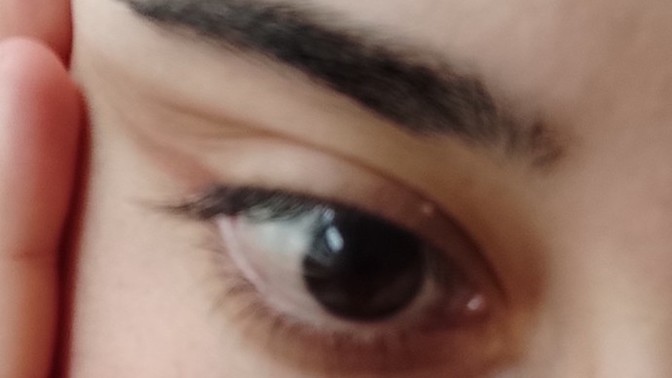 Gözümün beyaz kısmı neden lekeli duruyor sarı gibi anlamadım, bu nedir 🙄?
