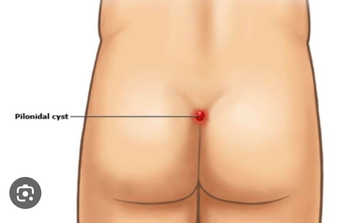 Kıl dönmesinin çözümü nedir?