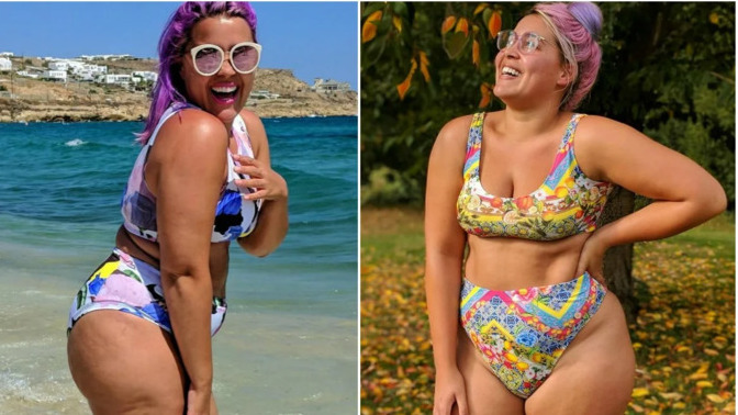 Sahilde bikini giyerken çatlaklarınızdan, selülitlerinizden utanmıyor musunuz?