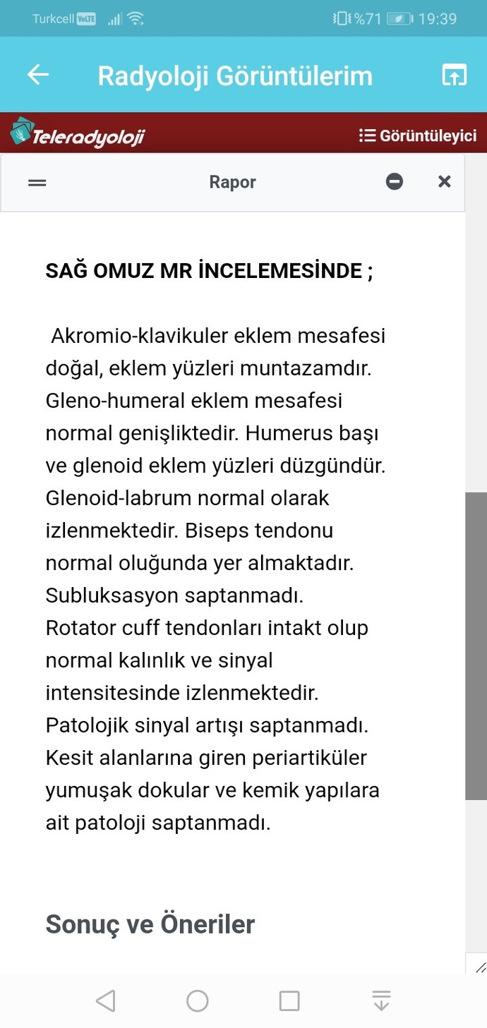 Sağlıkçı kankiler sizce lif yırtığım var mı?