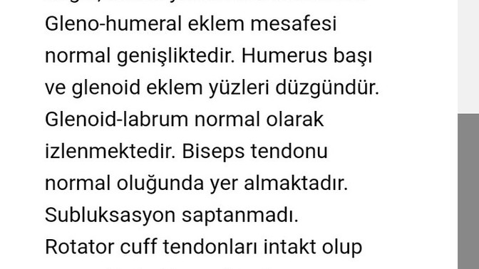 Sağlıkçı kankiler sizce lif yırtığım var mı?