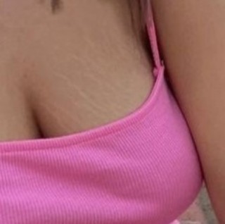 Sizce bu çatlaklar çirkin mi gösteriyor vücudu?