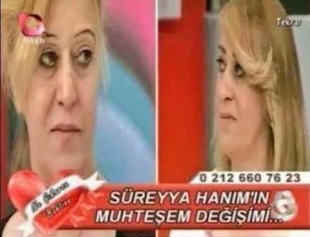 Kirpik lifting ne kadar süre kalıyor?