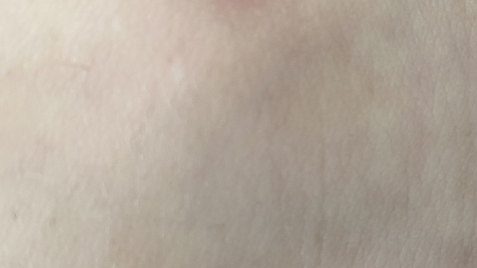 Tıraş bıçağı izi nasıl geçer?