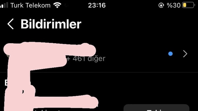 İlgiden bunaliyorumm napmaliyim?