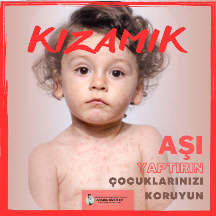 Kızamık vakalarında artış gözleniyor, çocuklarınıza kızamık aşısı yaptırdınız mı?