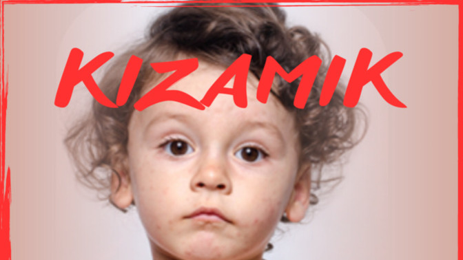 Kızamık vakalarında artış gözleniyor, çocuklarınıza kızamık aşısı yaptırdınız mı?