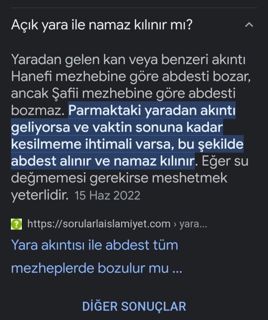Yarali olan biri namaz kılıp oruç tutabiliyorken namaz kilabiliyorken adetli kadinlara neden haram?