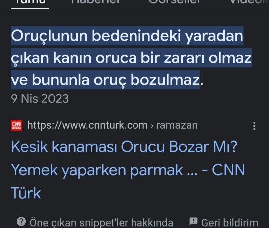 Yarali olan biri namaz kılıp oruç tutabiliyorken namaz kilabiliyorken adetli kadinlara neden haram?