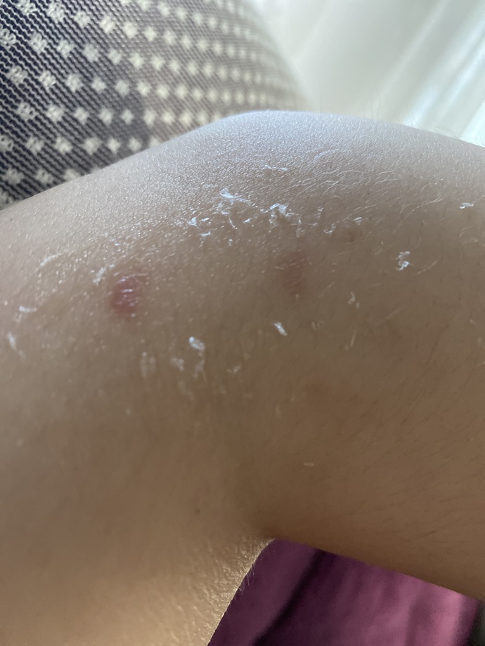 Aranızda thy çalışanı var mı? kabin memurluğunda bu tırnak izi önemli mi?