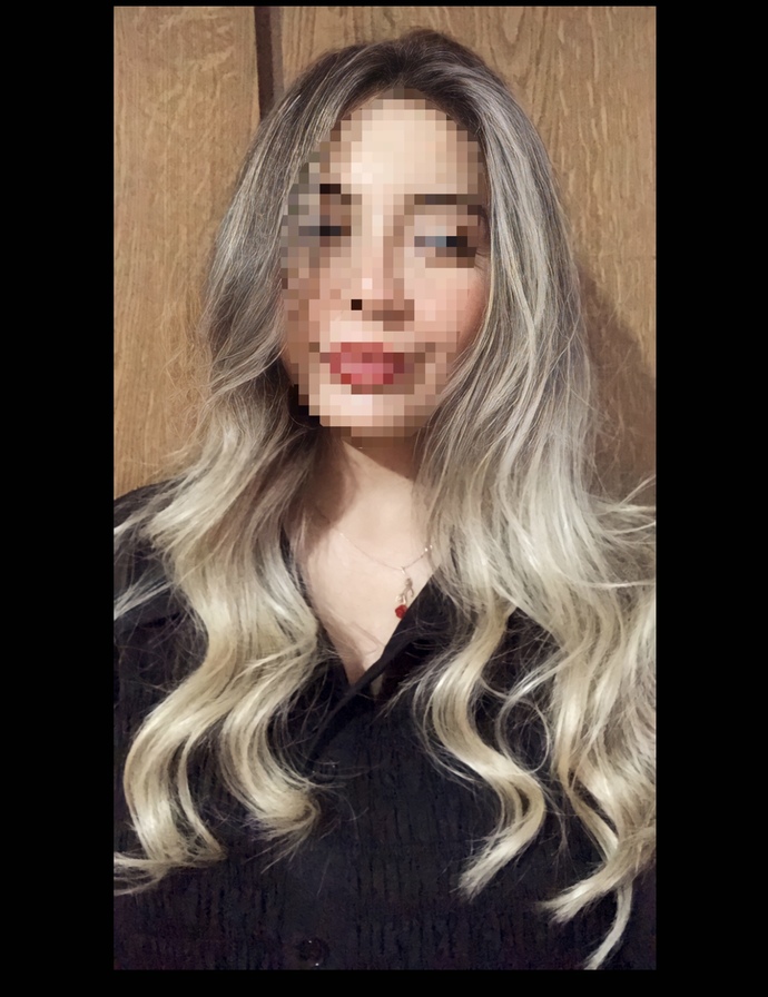 Sarı mı kahve mi?