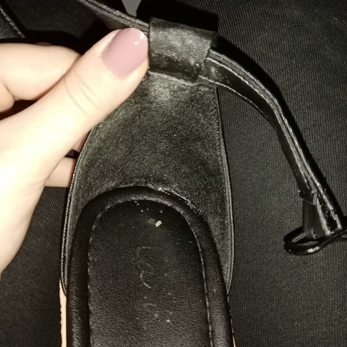 Yeni ayakkabı aldım ama ayağımın arka tarafını yara yapıyor. Ne yapabilirim?
