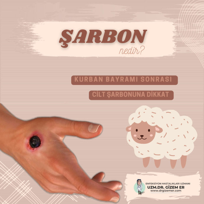Kurban Bayramı Sonrası Dikkat, Şarbon Nedir?