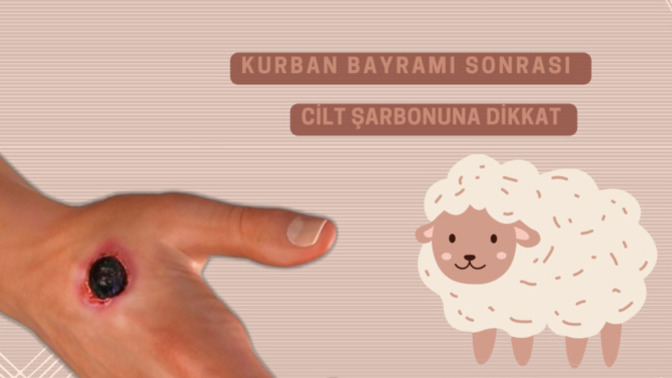 Kurban Bayramı Sonrası Dikkat, Şarbon Nedir?