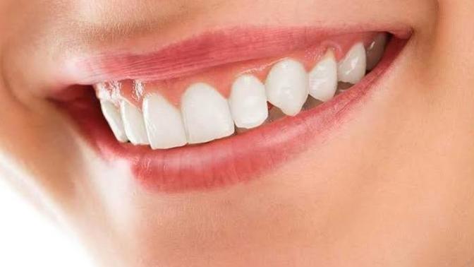 Diş etine masaj yapılır mı?