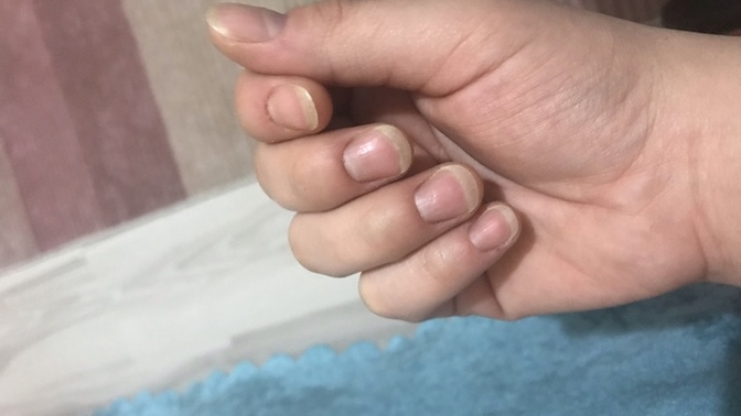 Tırnak uzatmaya başladım, bu kadar kafi mi yoksa devam mı?