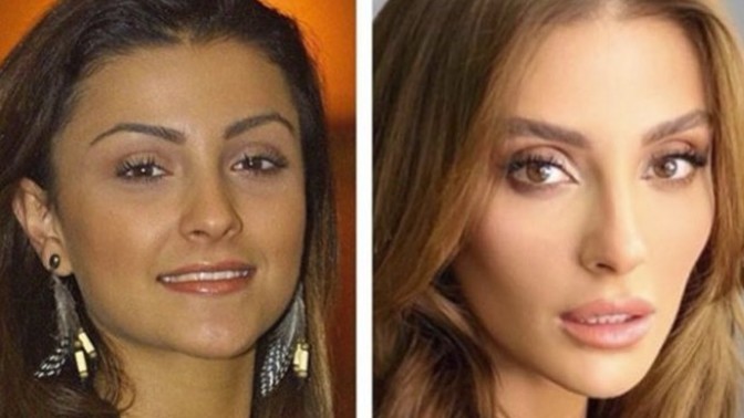 Estetikli kadinlar size de itici geliyor mu?