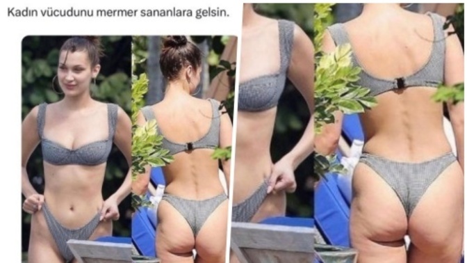 Selüliti olan kadınlar bikini giyemez mi?