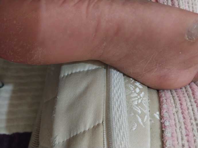 Bu ayak nasıl, bir bakıma ihtiyacı var mı?