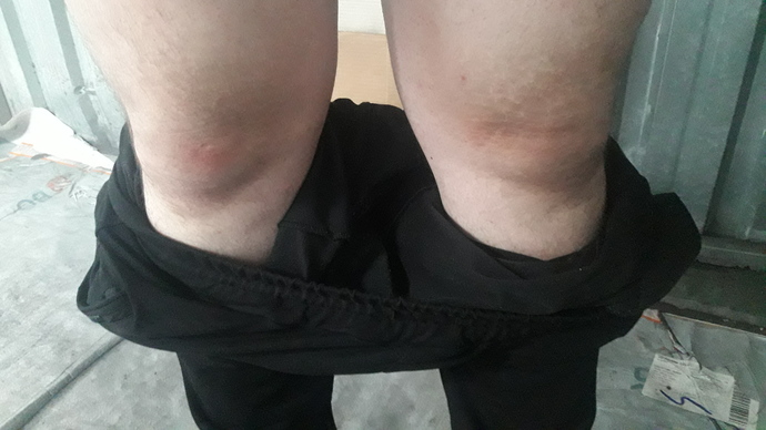 Sol dizimde düz çizgi vae ve sürekli batıyor