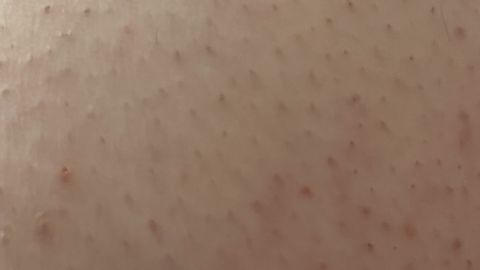 Bu görüntüden nasıl kurtulabilirim acil bakar mısınız?