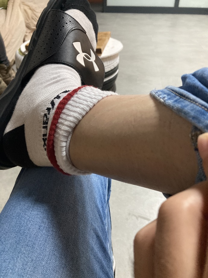 Bacağımın üstünde inanılmaz sepinti oluyor sizce nedeni nedir?