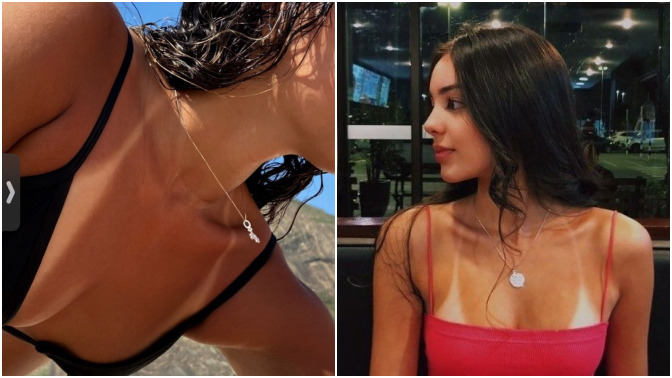 Güneş kremi kullanmadığım için çok kötü bikini izi çıktı. Çirkin bir görüntü mü sizce?