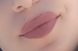 İnce dudaklar dolgu yaptırmalı mı 👄💉?