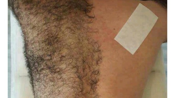 Erkeklerin sırtına bile ağda yaptırdıkları doğru mu?