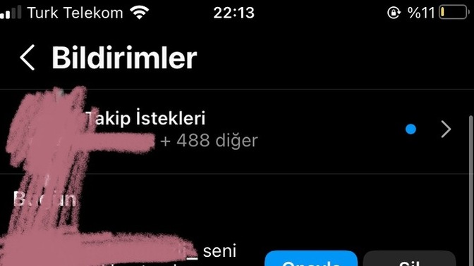 Bu kadar ilgi beni sıkıyor, ne yapacağım?