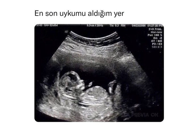 Uykunu alabiliyor musun?
