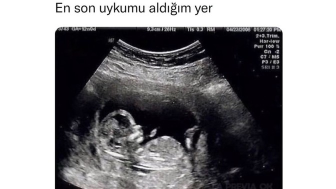 Uykunu alabiliyor musun?