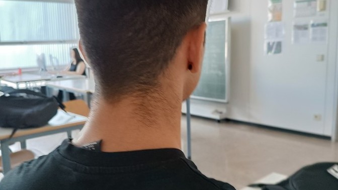 Büyük kafa sorunu?