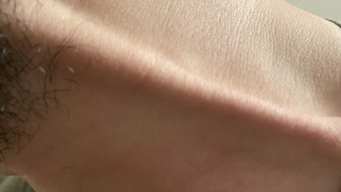 Boynumda 15 dk önce böyle bir damar çıktı ne damarı bu?