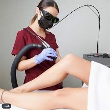 Genital bölge lazer epilasyon yaptıran var mı?