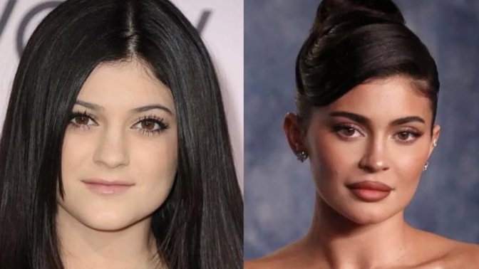 Kylie Jenner, daha önce hiç estetik operasyon geçirmediğini açıkladı. Açıklaması sizce inandırıcı mı?