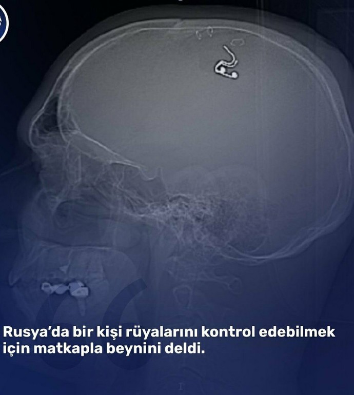Görselini en iyi ifade eden kısa notunu buraya ekleyebilirsin