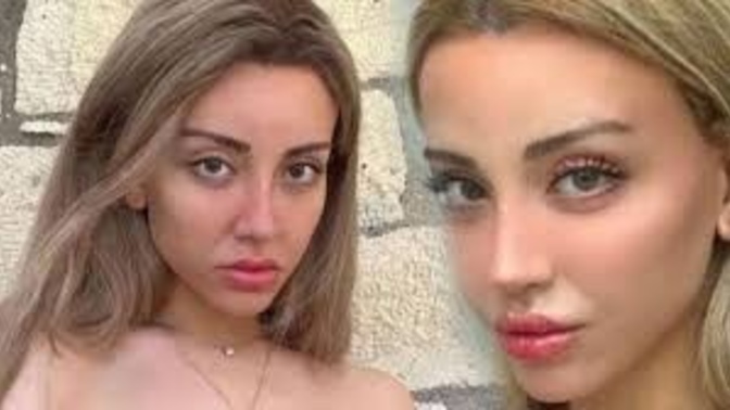 Hamile kalmış mika raun?