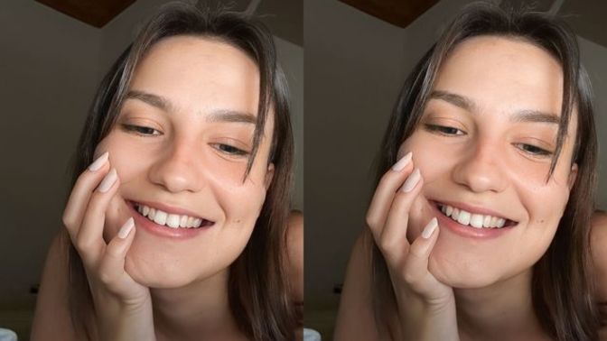 Ön dişim kırıldı, duruşu hoşuma gitmiyor. Sizce kötü mü duruyor?