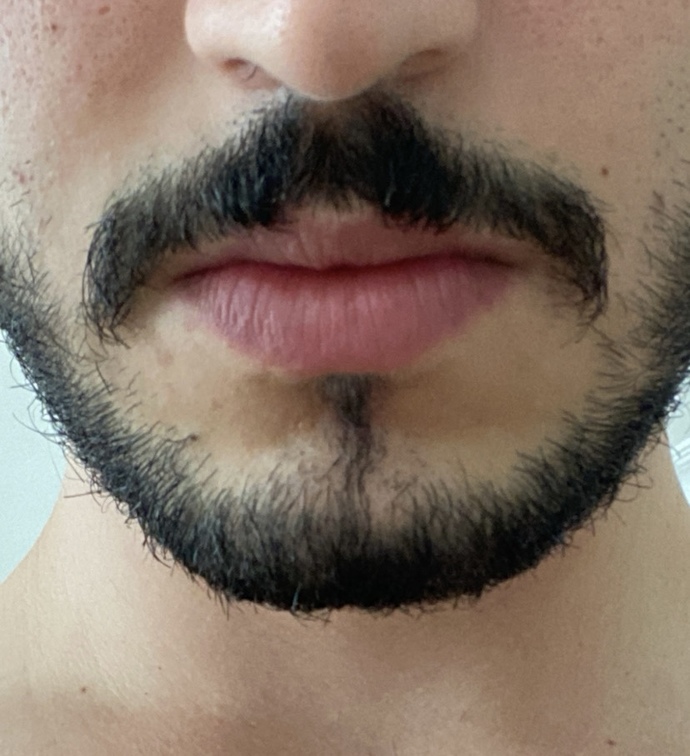 Dağınık bıyık nasıl düzeltilir?