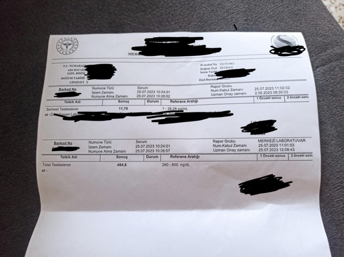Testosteron değerlerim düşük mü?