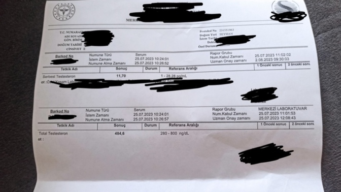 Testosteron değerlerim düşük mü?
