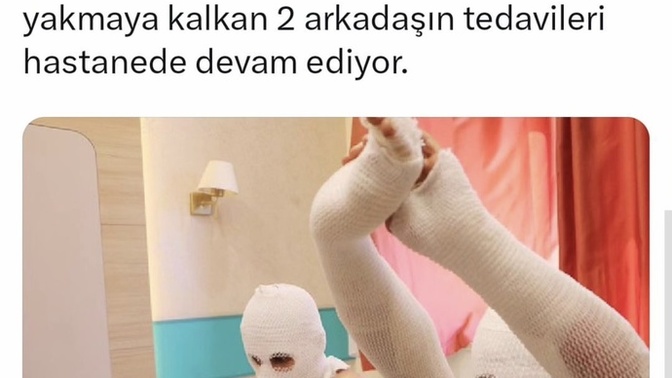 NASIL Bİ KAFA YASIYORLARSA ARTIK?