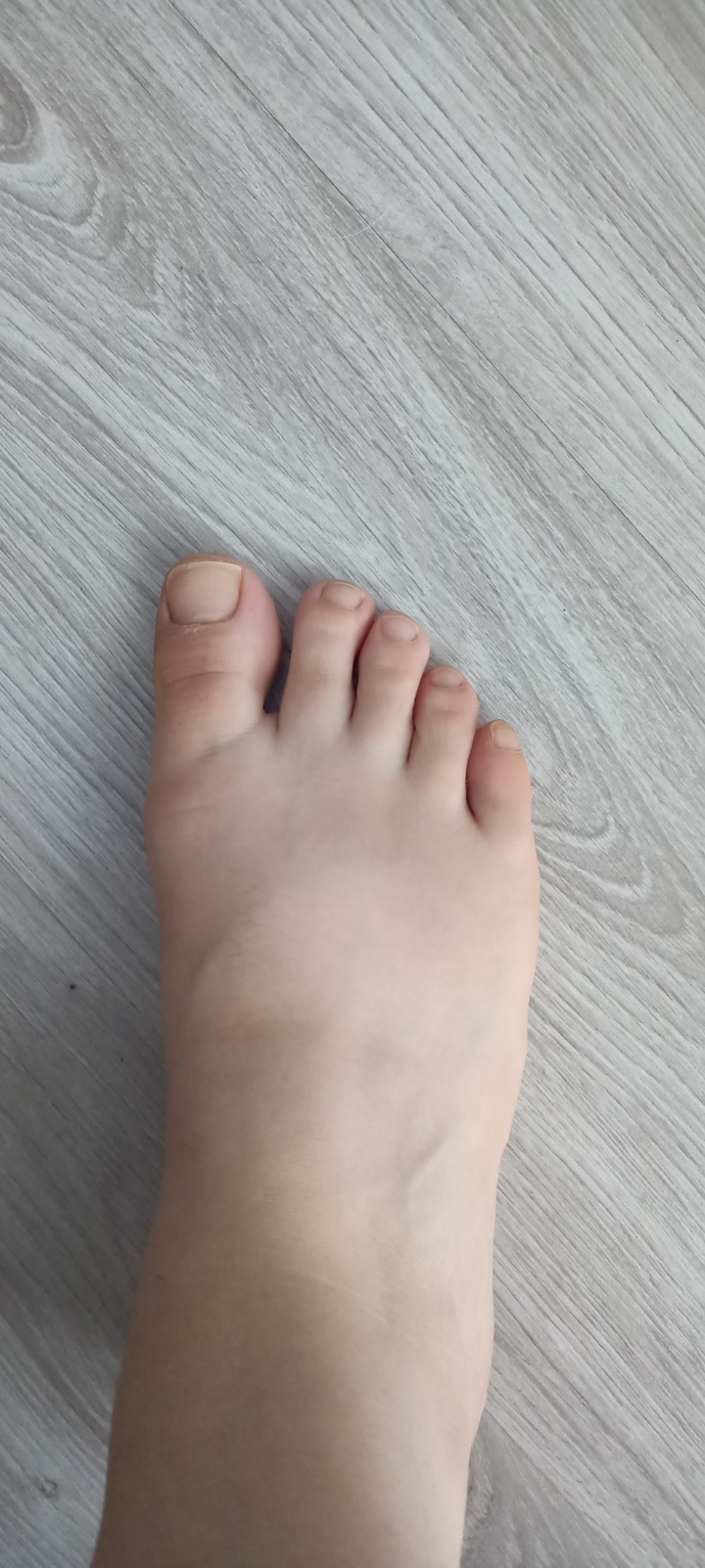 Ayaklarımı nasıl inceltebilirim?