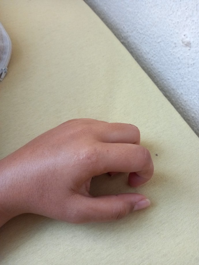 Elimde lekelenme, kaşıntı ve renk değişikliği var. Sebebi ne olabilir?