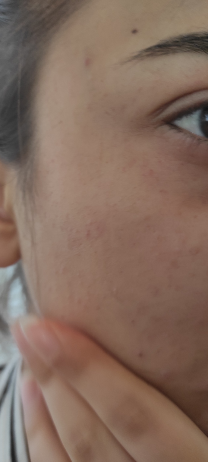 Yasmin doğum kontrol ilacı ile kan ve B12 ilacı birlikte kullanılır mı?
